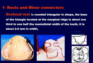 Marginal Ridge Rests 7- Mouth and abutment preparation.pptx