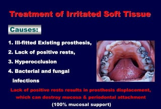 7- Mouth and abutment preparation.pptx