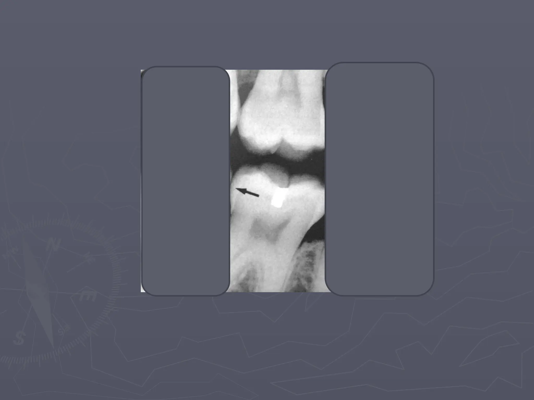 7-Normal Radiographic Anatomy-updated..pptx