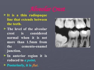 Alveolar Crest
► It is a thin radiopaque
line that extends between
the teeth.
► The level of the alveolar
crest is considered
normal when it is not
more than 1.5mm from
the cemento-enamel
junction.
► In anterior region it is
reduced to a point.
► Posteriorly, it is flat.
 