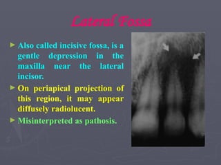 Lateral Fossa
► Also called incisive fossa, is a
gentle depression in the
maxilla near the lateral
incisor.
► On periapical projection of
this region, it may appear
diffusely radiolucent.
► Misinterpreted as pathosis.
 