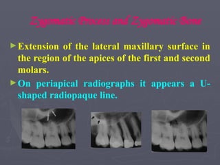 Zygomatic Process and Zygomatic Bone
►Extension of the lateral maxillary surface in
the region of the apices of the first and second
molars.
►On periapical radiographs it appears a U-
shaped radiopaque line.
 