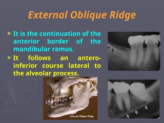External Oblique Ridge
► It is the continuation of the
anterior border of the
mandibular ramus.
► It follows an antero-
inferior course lateral to
the alveolar process.
 
