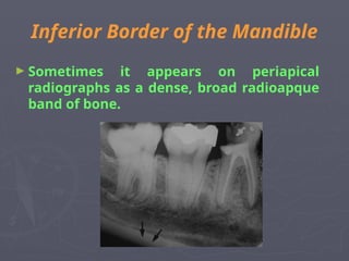Inferior Border of the Mandible
► Sometimes it appears on periapical
radiographs as a dense, broad radioapque
band of bone.
 