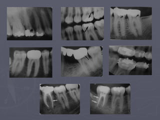 7-Normal Radiographic Anatomy-updated..pptx