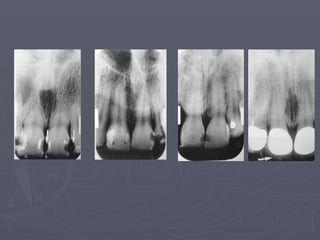7-Normal Radiographic Anatomy-updated..pptx
