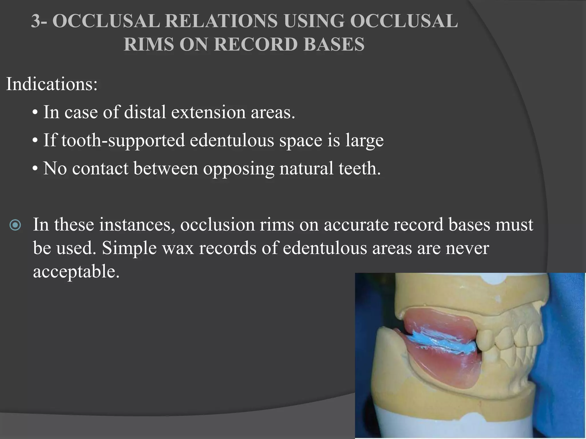 Occlusal Record Rpd Occlusion in Removable Partial Dentures | PPT