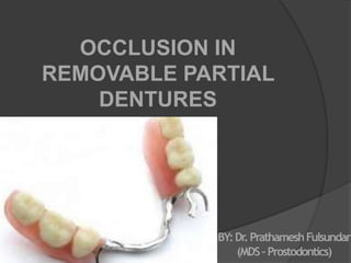 OCCLUSION IN
REMOVABLE PARTIAL
DENTURES
BY:Dr.PrathameshFulsundar
(MDS–Prostodontics)
 