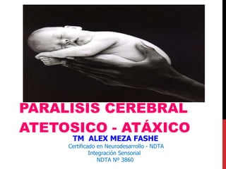 PARALISIS CEREBRAL ATETOSICO - ATÁXICO TM  ALEX MEZA FASHE Certificado en Neurodesarrollo - NDTA  Integración Sensorial NDTA Nº 3860 