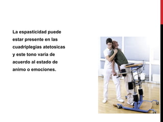 La espasticidad puede estar presente en las cuadriplegias atetosicas y este tono varia de acuerdo al estado de  animo o emociones. 