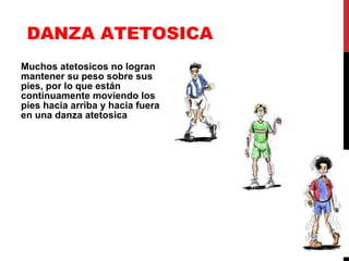 DANZA ATETOSICA Muchos atetosicos no logran mantener su peso sobre sus pies, por lo que están continuamente moviendo los pies hacia arriba y hacia fuera en una danza atetosica 