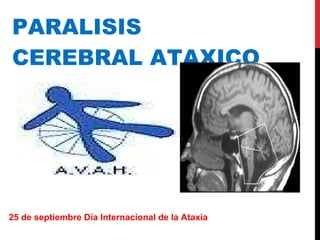 PARALISIS CEREBRAL ATAXICO 25 de septiembre Día Internacional de la Ataxia 
