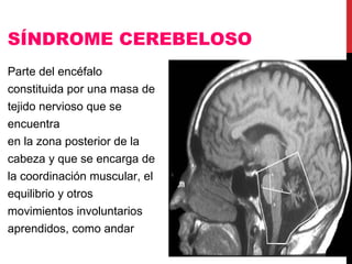 SÍNDROME CEREBELOSO Parte del encéfalo constituida por una masa de tejido nervioso que se encuentra  en la zona posterior de la cabeza y que se encarga de la coordinación muscular, el equilibrio y otros movimientos involuntarios aprendidos, como andar :   