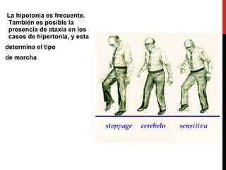 La hipotonia es frecuente. También es posible la presencia de ataxia en los casos de hipertonia, y esta determina el tipo de marcha 