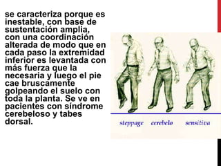 se caracteriza porque es inestable, con base de sustentación amplia, con una coordinación alterada de modo que en cada paso la extremidad inferior es levantada con más fuerza que la necesaria y luego el pie cae bruscamente golpeando el suelo con toda la planta. Se ve en pacientes con síndrome cerebeloso y tabes dorsal.  