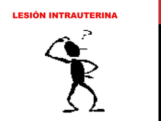 LESIÓN INTRAUTERINA 