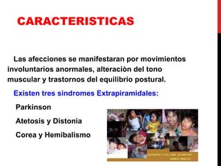 CARACTERISTICAS Las afecciones se manifestaran por movimientos involuntarios anormales, alteraciòn del tono muscular y trastornos del equilibrio postural. Existen tres sindromes Extrapiramidales: Parkinson Atetosis y Distonia  Corea y Hemibalismo 