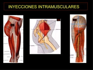 INYECCIONES   INTRAMUSCULARES   CSE CSE CSE 