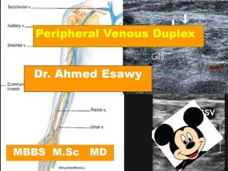 7 peripheral venous duplex perforating veins  anatomy dr ahmed esawy