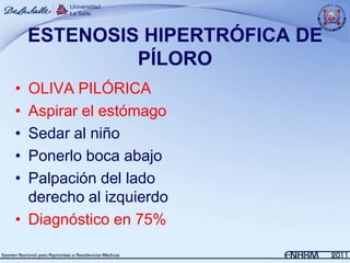 7. Estenosis Hipertrófica de píloro pediatría | PPTX