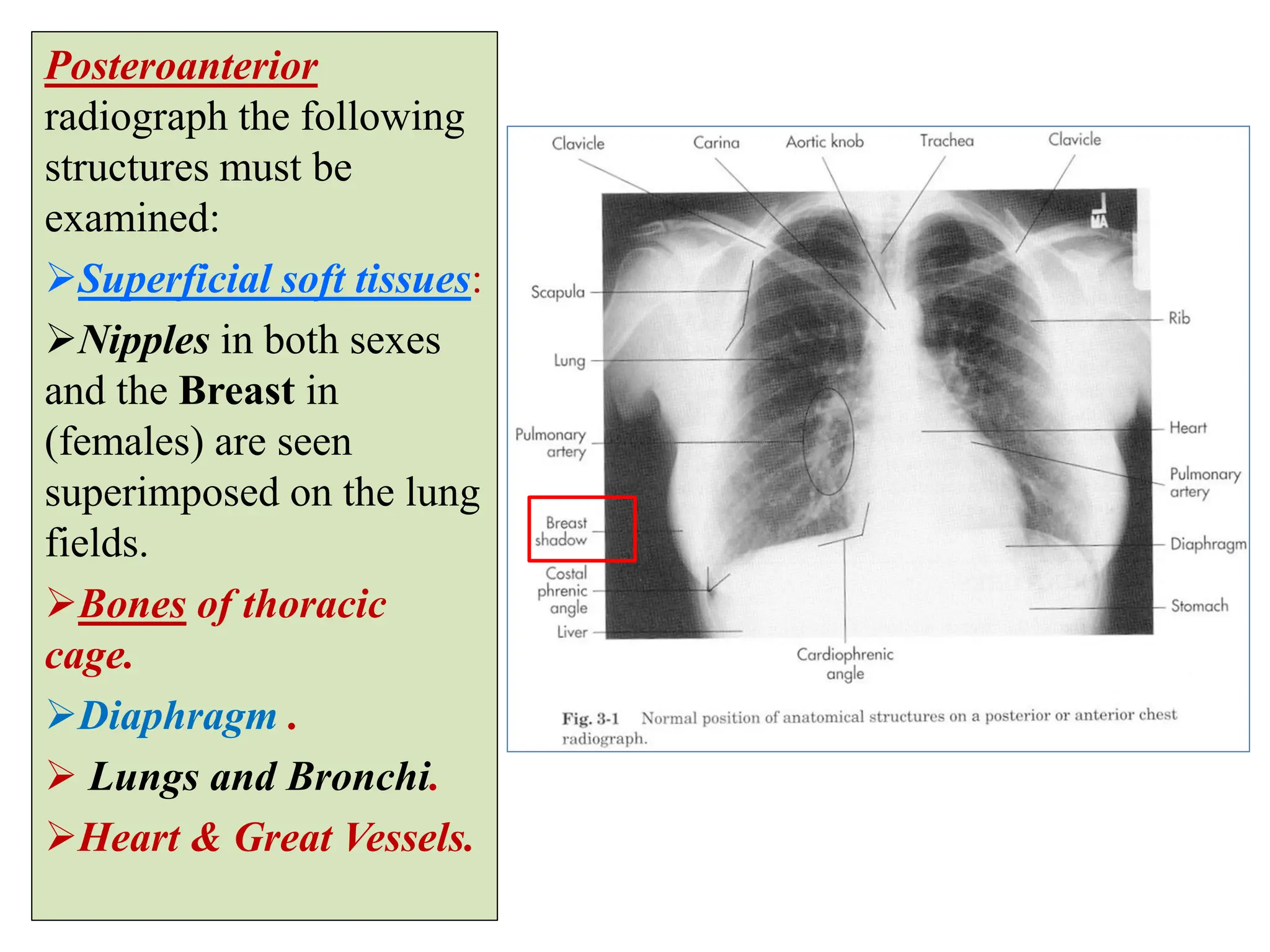 Human Thoracci Radiograph 7- Radiological Anatomy of Thorax....pdf
