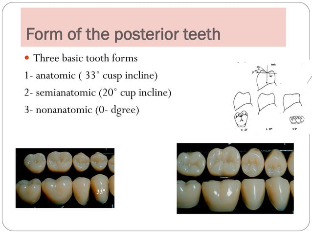 7 selection of teeth and esthetics in complete denture | PDF | Dental ...