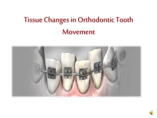 TissueChangesin Orthodontic Tooth
Movement
 