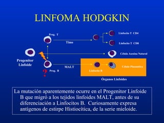 Progenitor
Linfoide
Linfocito T CD4
Linfocito T CD8
Célula Asesina Natural
Prog. T
Prog. B Linfocito B
Célula PlasmáticaMALT
Timo
Órganos Linfoides
LINFOMA HODGKIN
?
La mutación aparentemente ocurre en el Progenitor Linfoide
B que migró a los tejidos linfoides MALT, antes de su
diferenciación a Linfocitos B. Curiosamente expresa
antígenos de estirpe Histiocítica, de la serie mieloide.
 