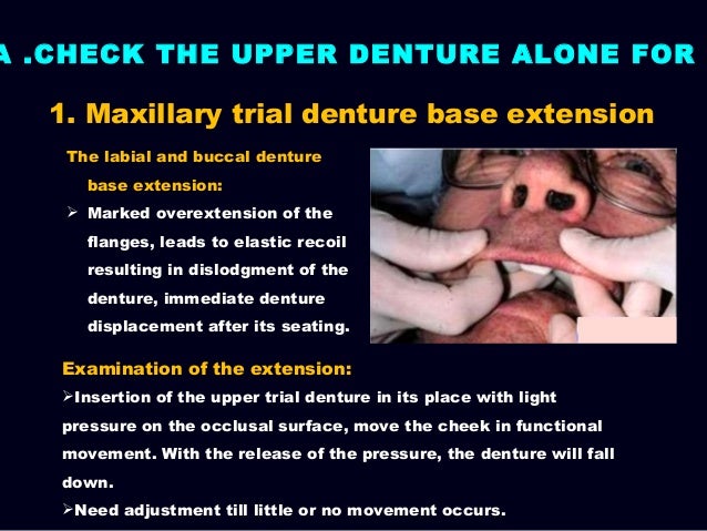 7 Try In Of The Wax Trial Complete Denture