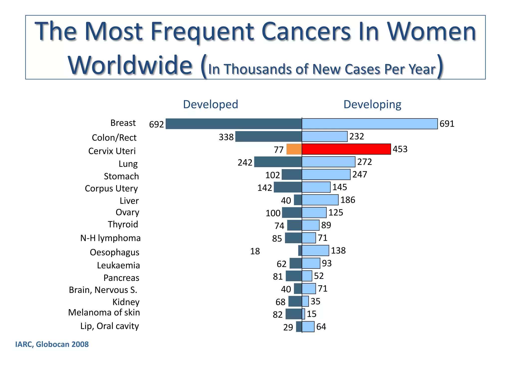 The Most Frequent Cancers In Women
      Worldwide (In Thousands of New Cases Per Year)
                                      Developed                              Developing
                         Breast 692                                                         691
                   Colon/Rect              338                                232
                  Cervix Uteri                            77                          453
                           Lung                  242                            272
                       Stomach                           102                   247
                 Corpus Utery                          142                 145
                           Liver                               40            186
                          Ovary                         100               125
                        Thyroid                           74            89
                N-H lymphoma                             85            71
                   Oesophagus                      18                     138
                     Leukaemia                             62           93
                      Pancreas                            81          52
             Brain, Nervous S.                              40         71
                         Kidney                            68        35
             Melanoma of skin                             82        15
                Lip, Oral cavity                             29       64
IARC, Globocan 2008
 