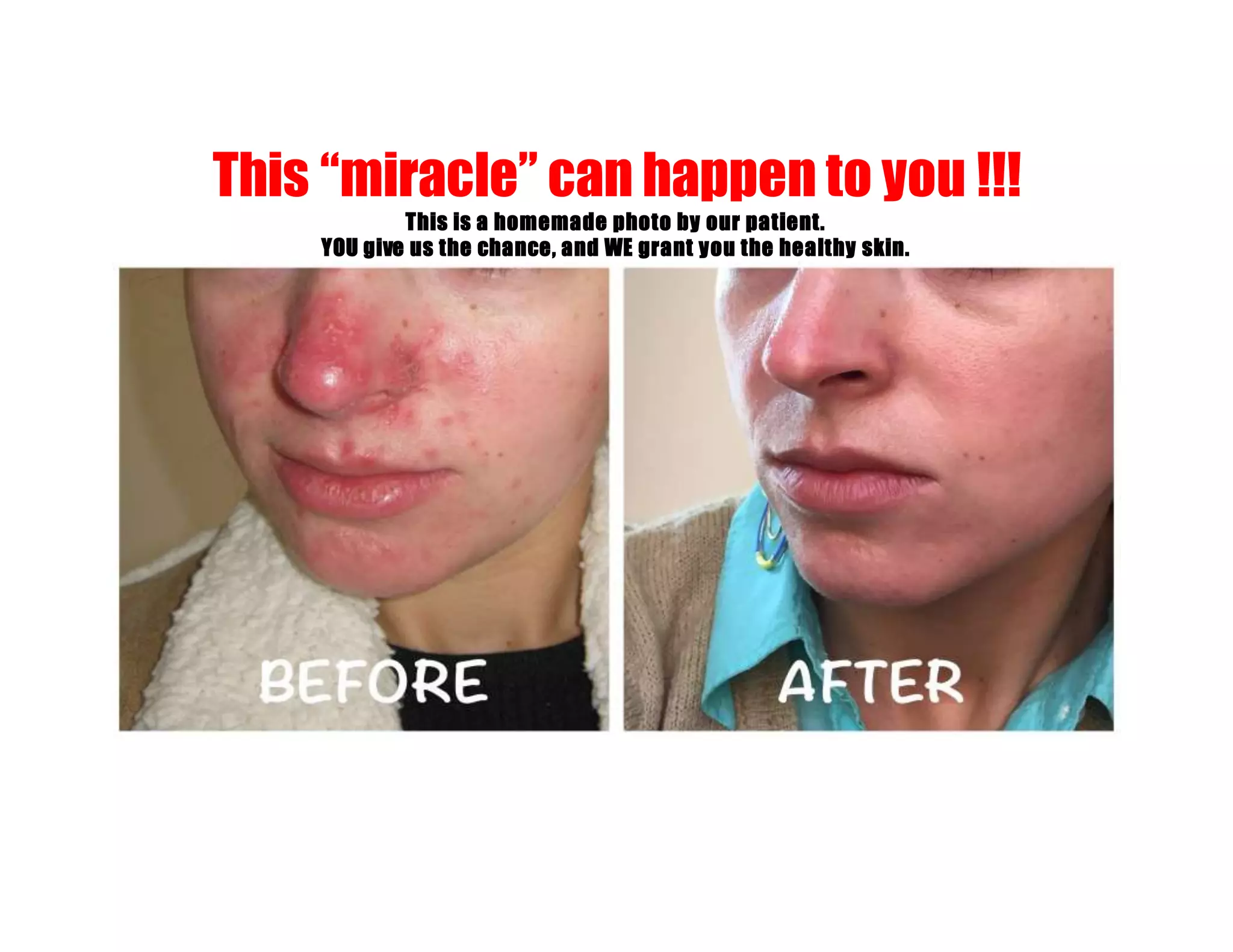 This “miracle” can happen to you !!!
This is a homemade photo by our patient.
YOU give us the chance, and WE grant you the healthy skin.