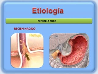 RECIEN NACIDO
SEGÚN LA EDAD
 