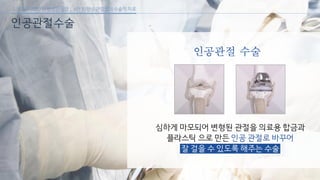 [삼성서울병원] 퇴행성 관절염 6편