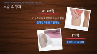 [삼성서울병원] 퇴행성 관절염 6편
