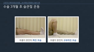 [삼성서울병원] 퇴행성 관절염 6편