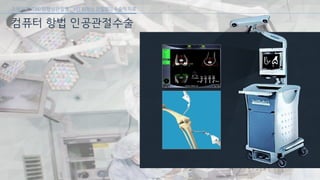 [삼성서울병원] 퇴행성 관절염 6편