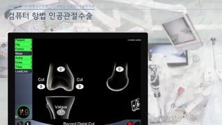 [삼성서울병원] 퇴행성 관절염 6편
