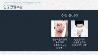[삼성서울병원] 퇴행성 관절염 6편