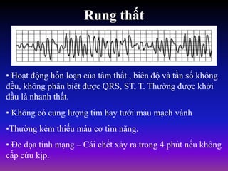 Rung thất
• Hoạt động hỗn loạn của tâm thất , biên độ và tần số không
đều, không phân biệt được QRS, ST, T. Thường được khởi
đầu là nhanh thất.
• Không có cung lượng tim hay tưới máu mạch vành
•Thường kèm thiếu máu cơ tim nặng.
• Đe dọa tính mạng – Cái chết xảy ra trong 4 phút nếu không
cấp cứu kịp.
 