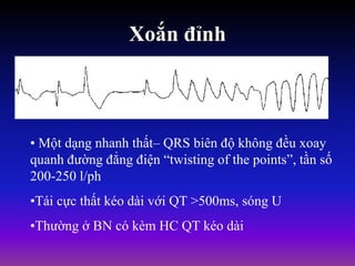 Xoắn đỉnh
• Một dạng nhanh thất– QRS biên độ không đều xoay
quanh đường đẳng điện “twisting of the points”, tần số
200-250 l/ph
•Tái cực thất kéo dài với QT >500ms, sóng U
•Thường ở BN có kèm HC QT kéo dài
 