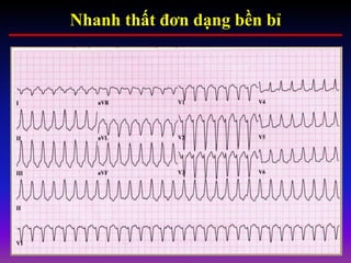 Nhanh thất đơn dạng bền bỉ
 