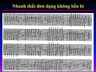 Nhanh thất đơn dạng không bền bỉ
 
