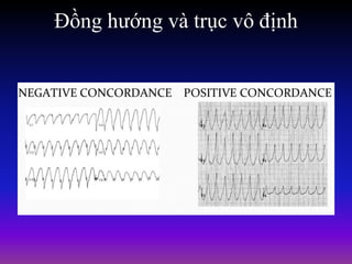 Đồng hướng và trục vô định
 