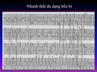 Nhanh thất đa dạng bền bỉ
 