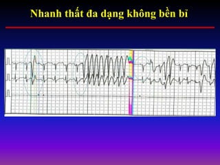 Nhanh thất đa dạng không bền bỉ
 