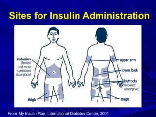 Sites for Insulin AdministrationSites for Insulin Administration
From My Insulin Plan, International Diabetes Center, 2001
 