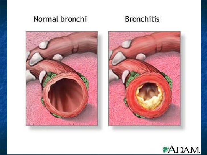 7[1].5 the importance of maintaining a healthy respiratory system