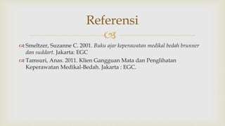 
 Smeltzer, Suzanne C. 2001. Buku ajar keperawatan medikal bedah brunner
dan suddart. Jakarta: EGC
 Tamsuri, Anas. 2011. Klien Gangguan Mata dan Penglihatan
Keperawatan Medikal-Bedah. Jakarta : EGC.
Referensi
 