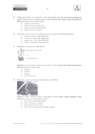 DOKUMEN NEGARA

                                                                     l0



29.     Tangan Ani terluka saat memotong wortel, lalu dengan cepat dia menutup luka dengan ibu
       jarinya. Beberapa saat kemudian lukanya tidak berdarah ldgi. Bagian darah yang berperan
        dalam penutupan luka tersebut adalah ....
             A, serum dan fibrinogen                     .



             B. fibrinogen dan keping darah
             C. keping darah dan plasma darah
           . D. plasma darah dan serum
30.    Tiga tahap pembentukan urine sebagai hasil kerja ginjal secara berurutan adalah ....
               A.filtrasi, reabsorbsi, dan augmentasi
               B.reabsorbsi, filtrasi, dan augmentasi
               C.augmentasi, filtrasi, dan reabsorbsi
               D,filtrasi, augmentasi, dan reabsorbsi

31.    Perhatikan perangkat percobaan berikutl

                              Gelembung-gelembung      udara



                              Air

                              Hydrilla (tanaman air)




       Rangkaian alat percobaan seperti pada gambar tersebut dipergunakan untuk membuktikan
       bahwa fotosintesis menghasilkan ....
              A. amilum
              B. glukosa
              C. oksigen
              D. karbondioksida
32"    Perhatikan gambar tumbuhan yang memiliki sulur berikut!




       Apabila di dekat tanaman tersebut ditancapkan sebilah bambu hingga mendekati sulur,
       bagaimana respon sulur tumbuhan tersebut?
              A.Sulur akan melilit pada bambu
              B.Sulur menjauh dari bambu
              C.Sulur akan tumbuh ke atas
              D.Sulur tidak terpengaruh oieh adanya bambu




('1-lPA-30-2()09i2()   | 1|                              ' IIak ('ipta patia ['usal I'cniIaian l'cndidikan-l]ALI1'IIANC-KFIMI-INDIKNAS
 