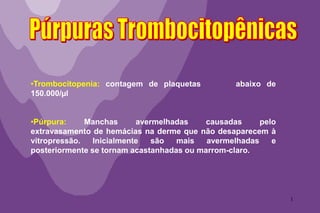 1
•Trombocitopenia: contagem de plaquetas abaixo de
150.000/µl
•Púrpura: Manchas avermelhadas causadas pelo
extravasamento de hemácias na derme que não desaparecem à
vitropressão. Inicialmente são mais avermelhadas e
posteriormente se tornam acastanhadas ou marrom-claro.
 